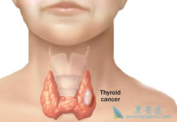 癌症晚期能活多久 癌症晚期能活多久