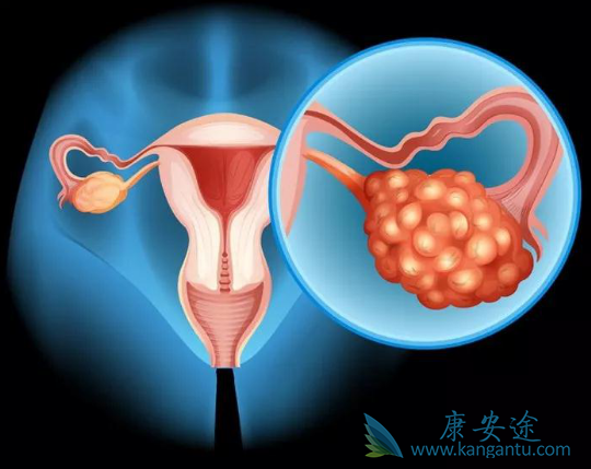 妇科肿瘤 妇科肿瘤