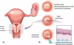 ��������������ɱ������Щ���ֱ�������ЧԤ����