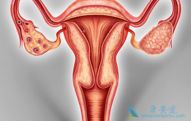 卵巢肿瘤 卵巢肿瘤