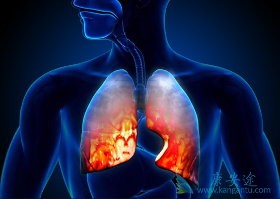 肺鳞癌 肺鳞癌