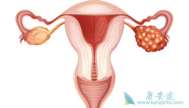 卵巢癌分期 卵巢癌分期