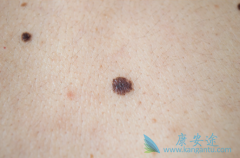 �￨������϶�������ת����֫�˺�ɫ������Ч��ô����