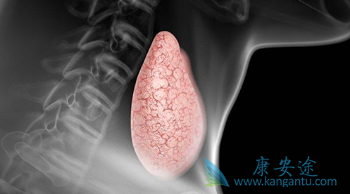 甲状腺腺瘤 甲状腺腺瘤