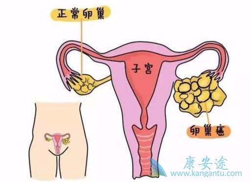 海外医疗 海外医疗