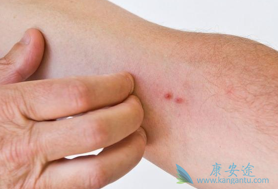 特罗凯副作用 特罗凯副作用