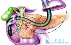 �������ٰ���֢״����Щ��