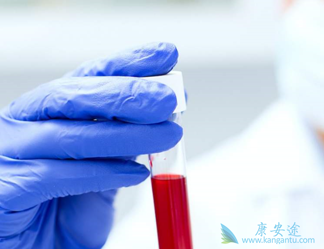 乙型肝炎表面抗体 乙型肝炎表面抗体