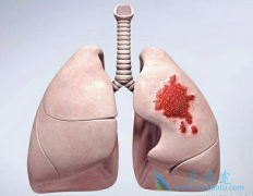 ��ķ�����ڷΰ������������򷢻�����Ҫ����