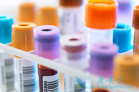 乙肝抗体 乙肝抗体