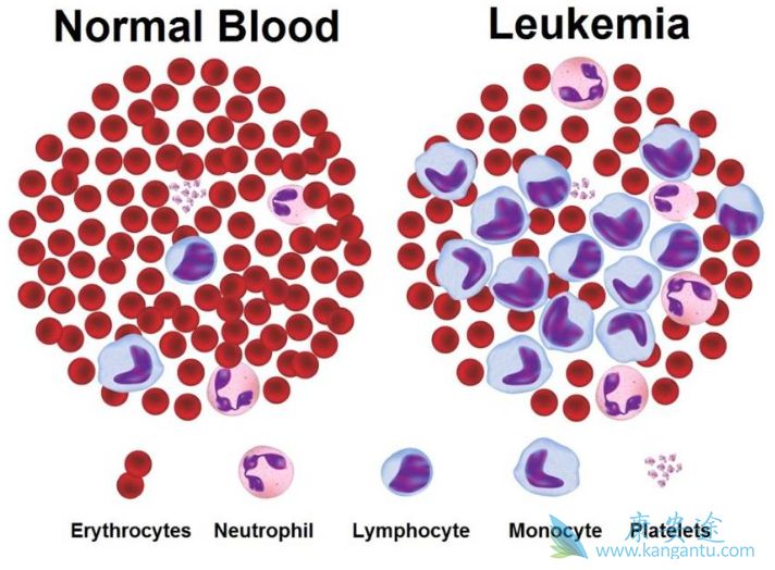 白血病能治好吗 白血病能治好吗
