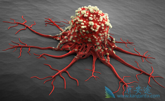 良性肿瘤与恶性肿瘤的区别 良性肿瘤与恶性肿瘤的区别