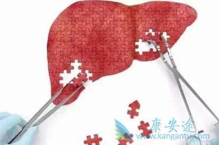 慢性丙肝能治好吗 慢性丙肝能治好吗