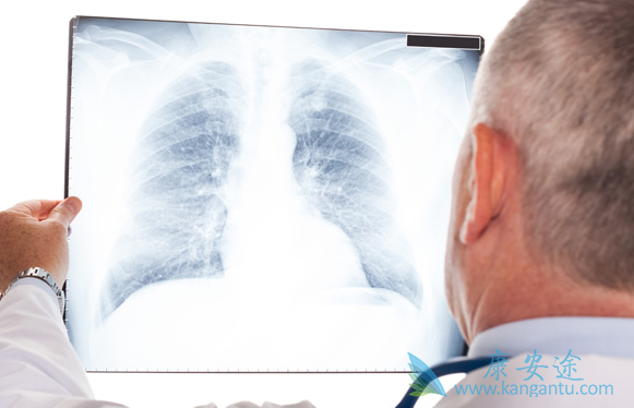 肺癌最好的治疗方法 肺癌最好的治疗方法
