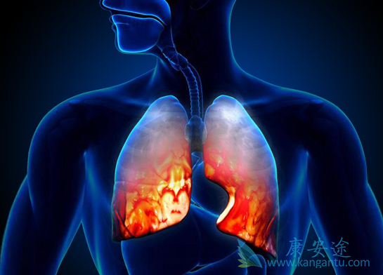 晚期肺鳞癌 晚期肺鳞癌
