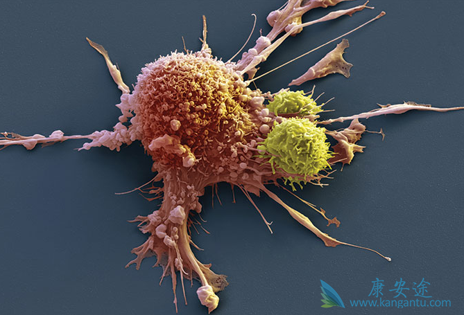 白血病的病因 白血病的病因