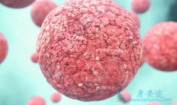 霍奇金淋巴瘤 霍奇金淋巴瘤