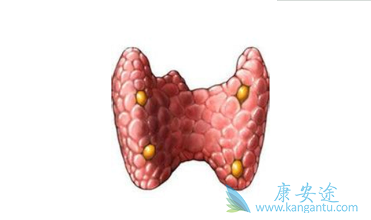 甲状腺腺瘤 甲状腺腺瘤