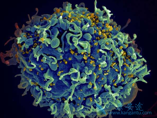 艾滋病 艾滋病