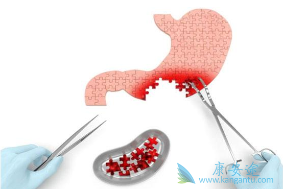 肿瘤转移 肿瘤转移