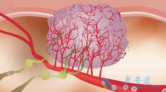 肿瘤治疗 肿瘤治疗