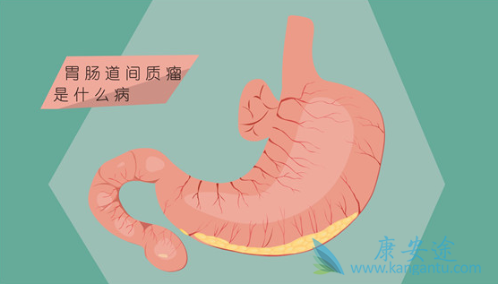 胃肠间质瘤 胃肠间质瘤