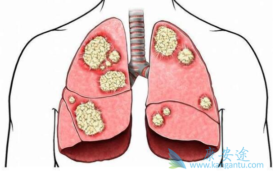 达克替尼 达克替尼