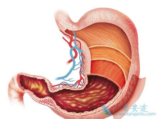 胃癌晚期能活多久 胃癌晚期能活多久