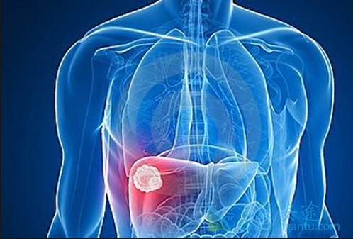 肝癌药物 肝癌药物