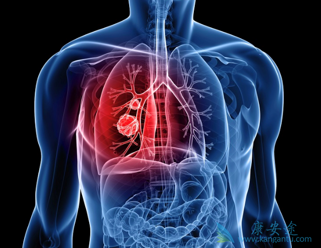 肺癌化疗 肺癌化疗