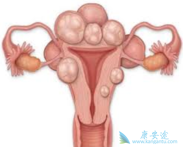 宫颈鳞癌 宫颈鳞癌