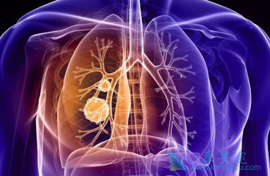 分子靶向治疗 分子靶向治疗