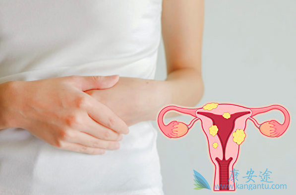 妇科肿瘤 妇科肿瘤