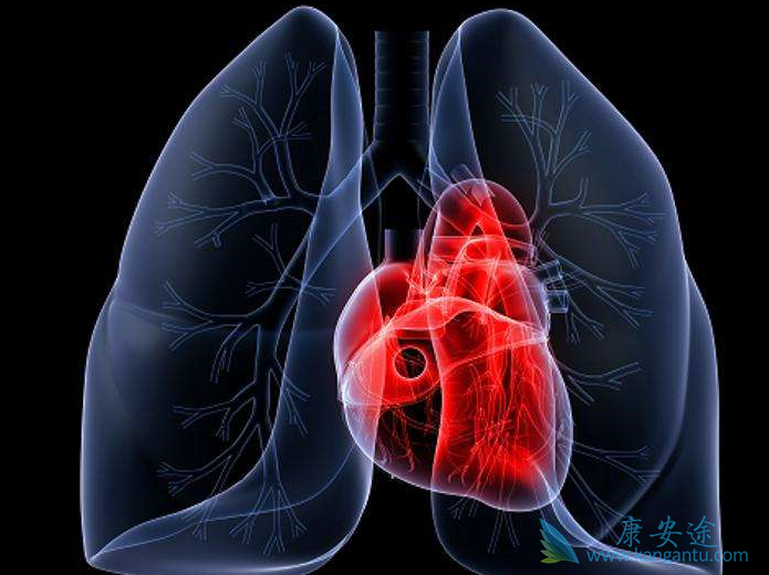 肺动脉高压治疗 肺动脉高压治疗