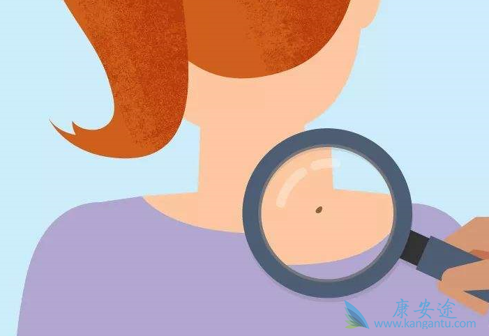 黑色素瘤 黑色素瘤