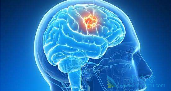 脑部肿瘤 脑部肿瘤