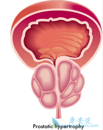 多西紫杉醇 多西紫杉醇