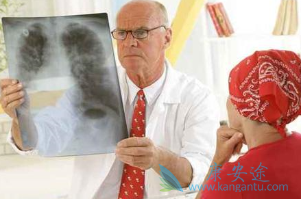 克唑替尼 克唑替尼