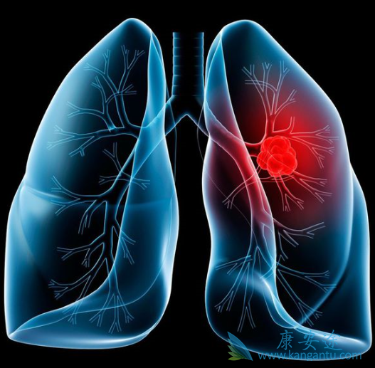 安罗替尼 安罗替尼