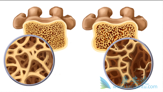双磷酸盐 双磷酸盐
