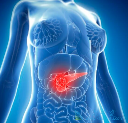 胰腺癌能治愈吗 胰腺癌能治愈吗