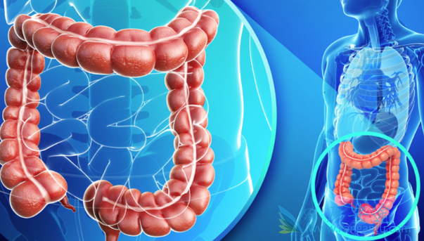 晚期转移性结直肠癌 晚期转移性结直肠癌