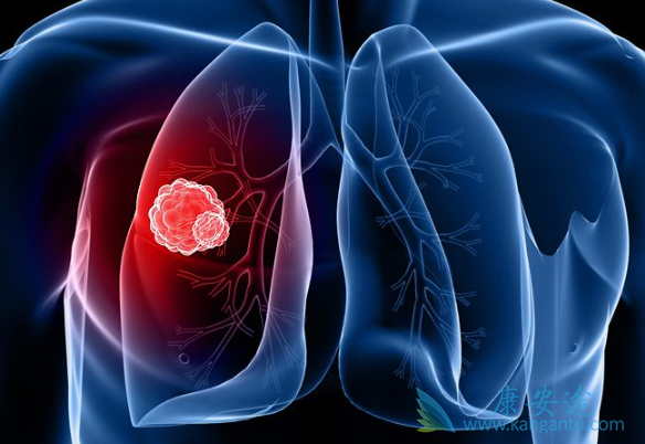 安罗替尼 安罗替尼