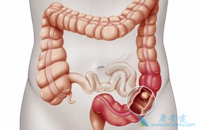 1559380473788944.png image.png