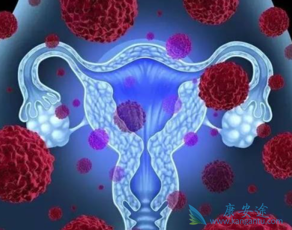 卵巢癌晚期能活多久 卵巢癌晚期能活多久