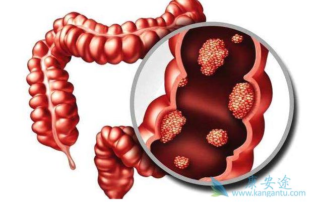 呋喹替尼 呋喹替尼