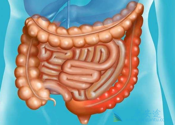 结直肠癌 结直肠癌