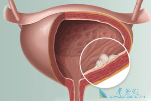 海外医疗 海外医疗