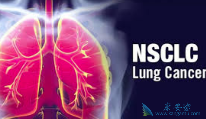 小细胞肺癌 小细胞肺癌