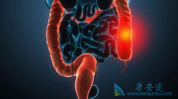 结直肠癌 结直肠癌